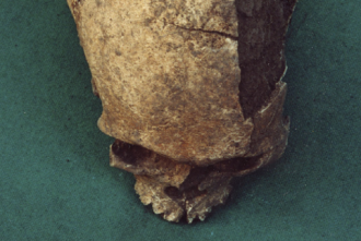 Поврежденный череп, найденный в Ла-Кемад