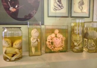 Эмбрионы, экспонаты Кунсткамеры